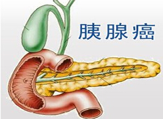 術中放射治療可提高胰腺癌患者生存率