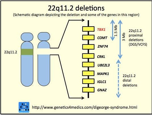 导致digeorge综合征的突变区域(图片来源:genetics4medics)
